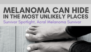 Featured image for “Survivor Spotlight:  Acral Melanoma Survivor”