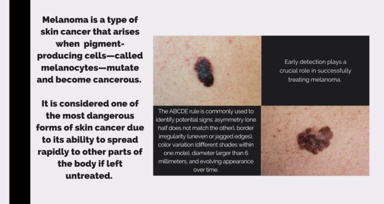 Melanoma 101 - AIM at Melanoma Foundation