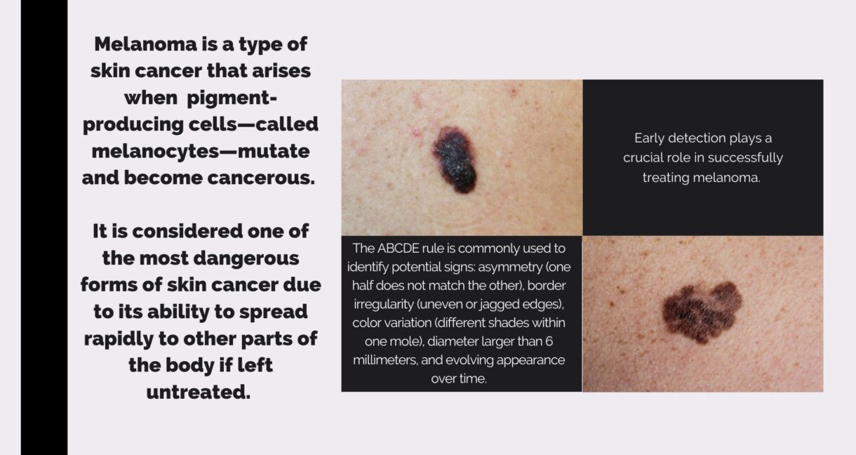 Common Side Effects