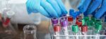 Featured image for “Three New Immunotherapy Agents Tested Against Melanoma in Phase 2 Clinical Trials”