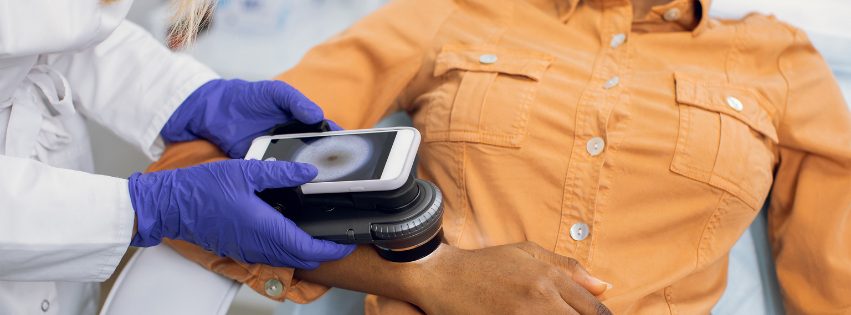 Featured image for “Images of Melanoma in People with Skin of Color”