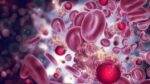 Featured image for “New Advances in Phase 3 Treatments for Melanoma”