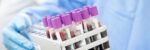 Featured image for “IO Biotech Announces Phase 3 Results for Cylembio® + KEYTRUDA® in Advanced Melanoma”