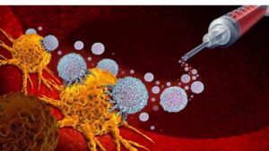 Featured image for “Immune Checkpoint Inhibition for Melanoma: A Focus on Veterans”