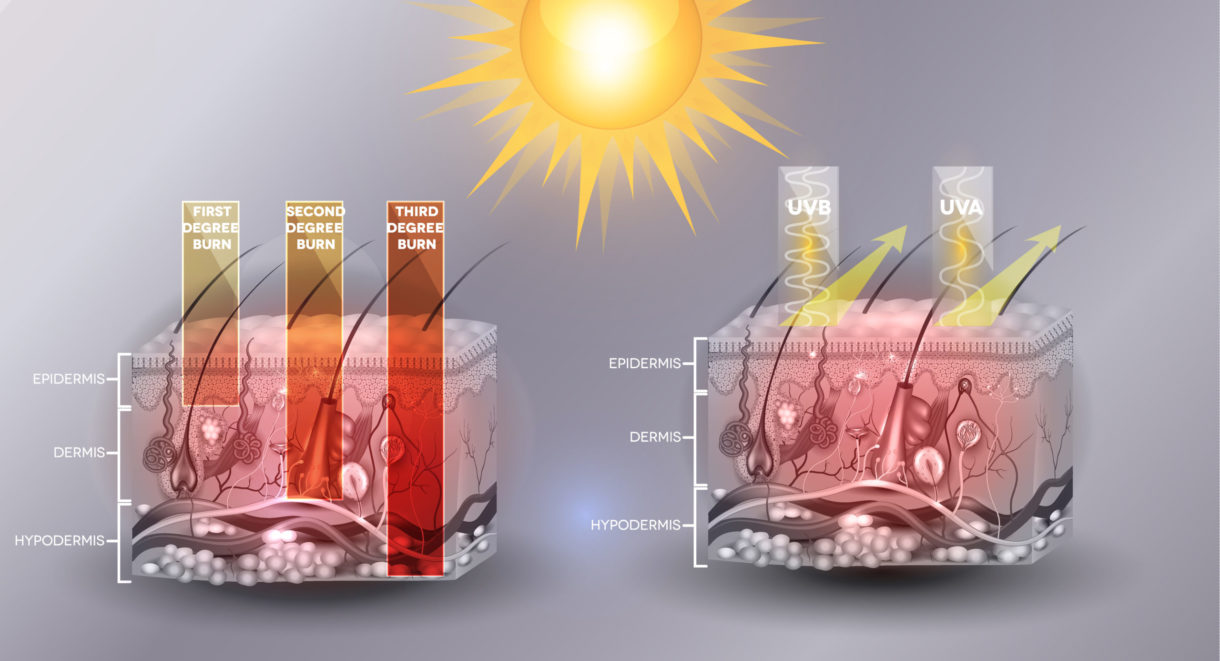 Ultraviolet (UV) Radiation - AIM at Melanoma Foundation