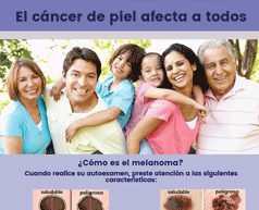 Prevención del melanoma en español