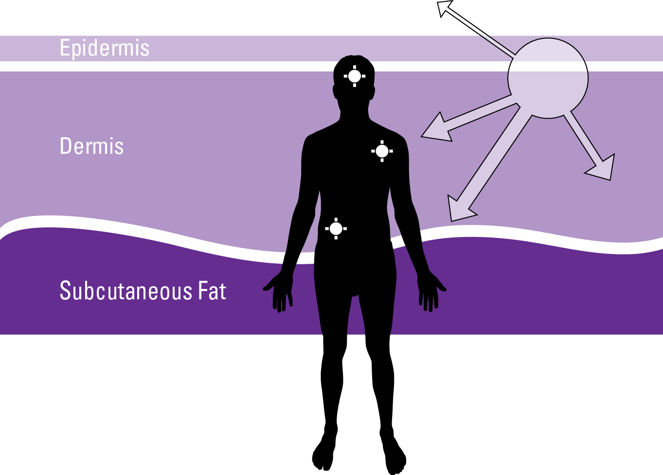 stages-of-melanoma-4