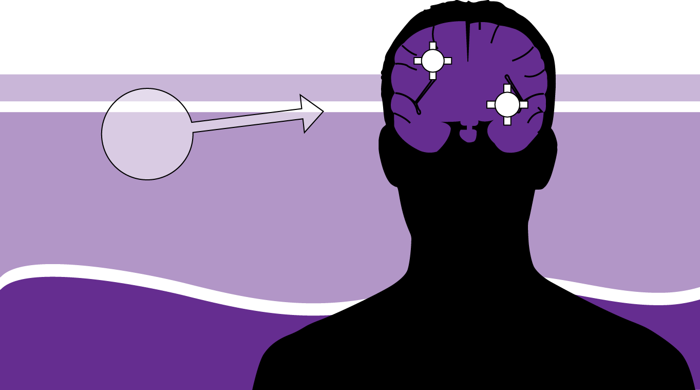 Blocking Inflammatory Pathway Key to Preventing Brain Metastasis from Melanoma